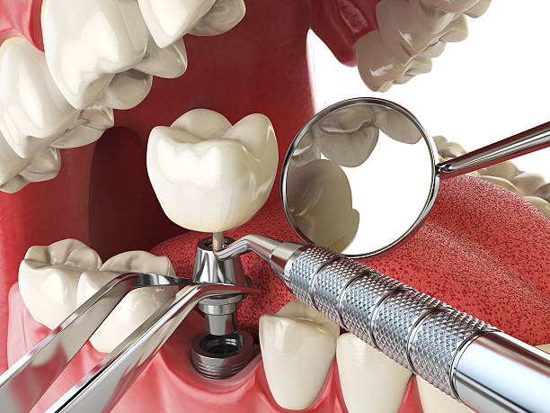 Best Emergency Dentist for Special Needs Patients in Bear Valley Springs, CA